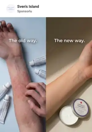 Meta Reklam Kütüphanesi, aktif reklam: Sven's Island