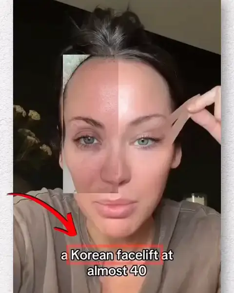 Dr.Melaxin creator videosu: a Korean facelift at almost 40 yazısı kırmızı çerçeveli